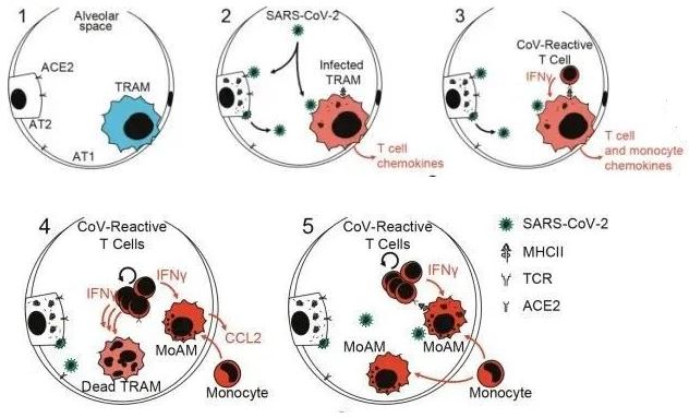 Circuits between infected macrophages and T cells in SARS-CoV-2 pneumonia Circuits between infected macrophages and T cells in SARS-CoV-2 pneumonia