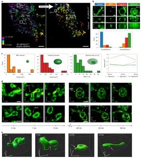 氧化應(yīng)激后線粒體的結(jié)構(gòu)變化 氧化應(yīng)激后線粒體的結(jié)構(gòu)變化