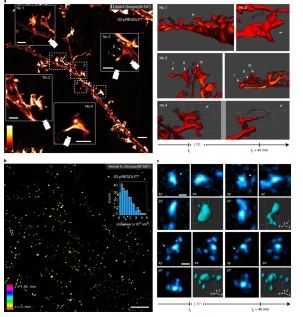 使用各向同性3D pRESOLFT進(jìn)行的突觸內(nèi)神經(jīng)元成像 使用各向同性3D pRESOLFT進(jìn)行的突觸內(nèi)神經(jīng)元成像