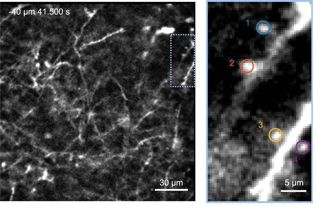 額葉皮層和樹突的樹突和棘 額葉皮層和樹突的樹突和棘