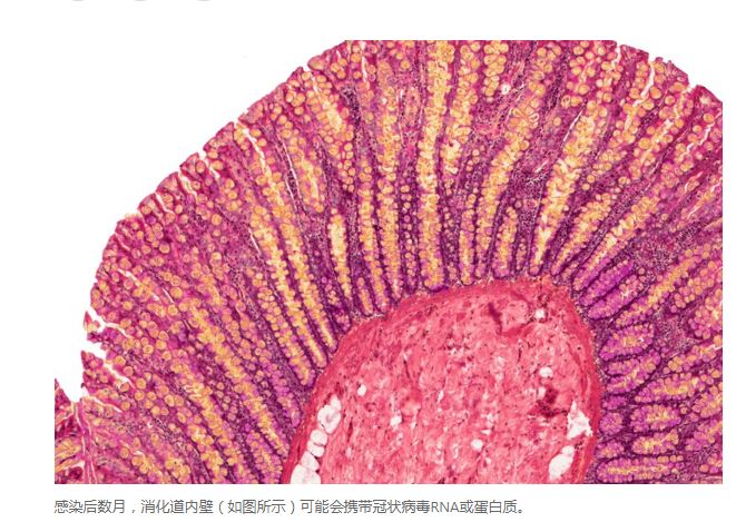 COVID研究更新:免疫細(xì)胞“記住” COVID至少半年 COVID研究更新:免疫細(xì)胞“記住” COVID至少半年