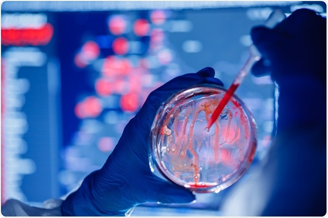 微生物鑒定的生化檢驗方法 微生物鑒定的生化檢驗方法