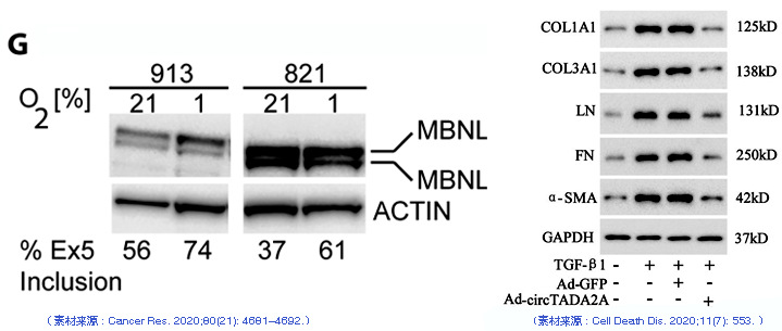 iBright FL1500采集的ECL Blot檢測(cè)圖像.jpg iBright FL1500采集的ECL Blot檢測(cè)圖像.jpg
